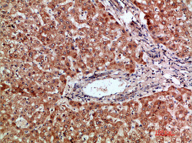 CCL20 antibody