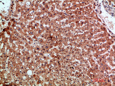 CCL20 antibody