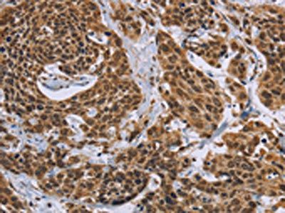 CCL21 Antibody