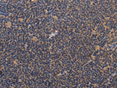 CCL23 Antibody