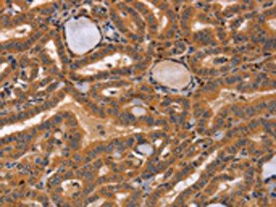 CCL23 Antibody
