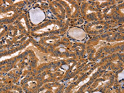 CCL23 antibody