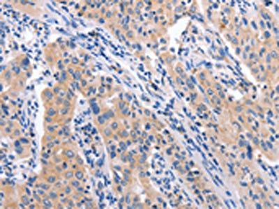 CCL23 Antibody