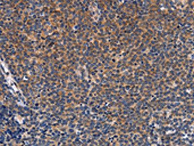 CCL23 Antibody