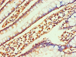 CCL25 antibody