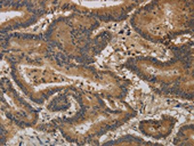 CCL26 Antibody