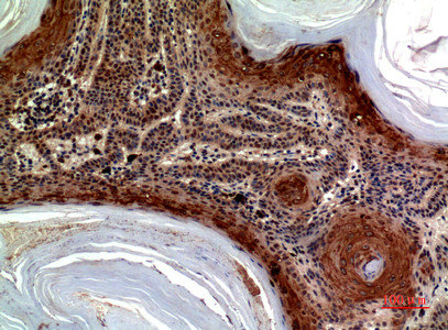 CCL27 Antibody