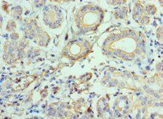 CCL28 Antibody
