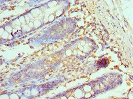 CCL28 antibody