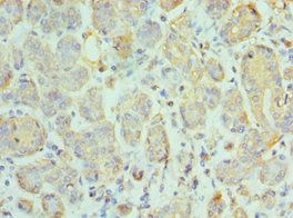 CCL28 Antibody