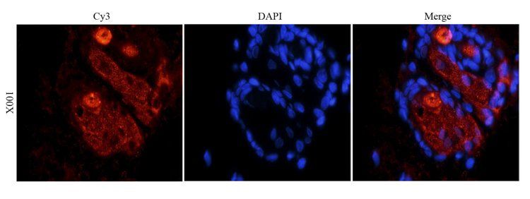 MCP1 antibody