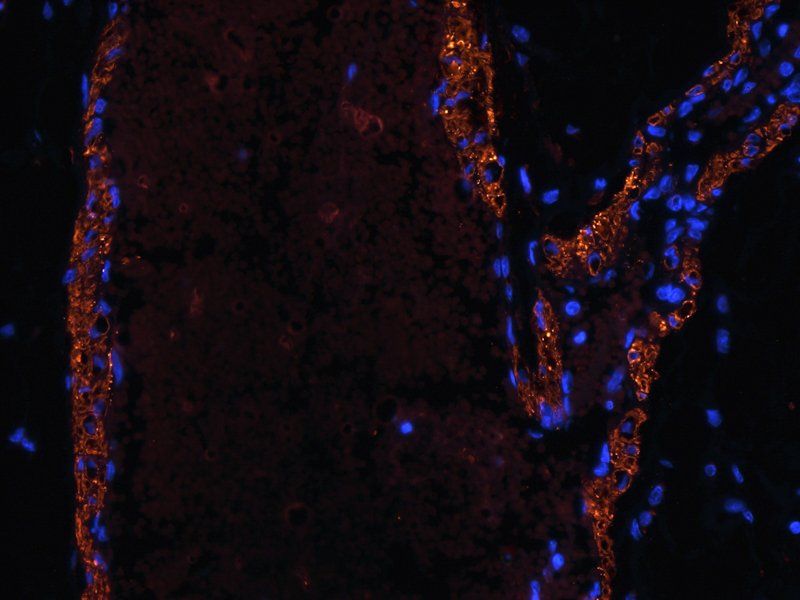 MCP1 antibody