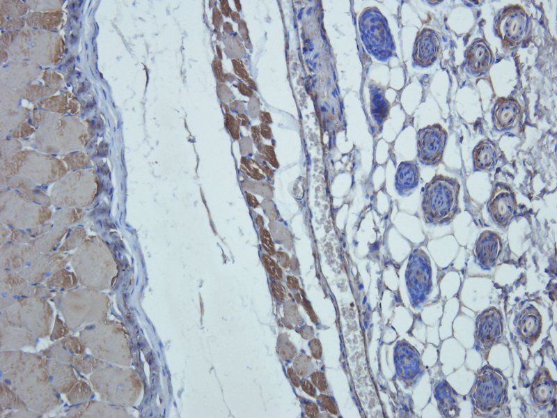 MCP1 antibody