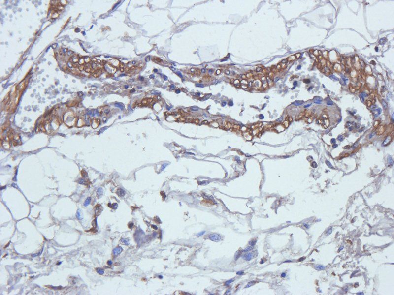 MCP1 antibody