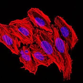 CCL2 Antibody