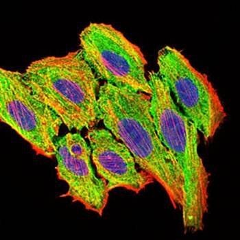 CCL2 Antibody