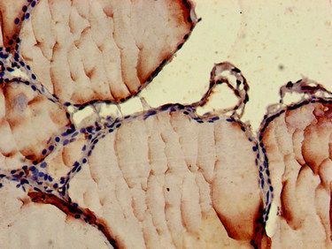 CCL3 Antibody