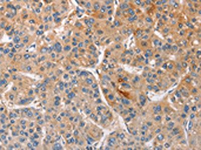 CCL4 Antibody