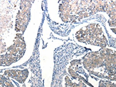 Ccl6 Antibody