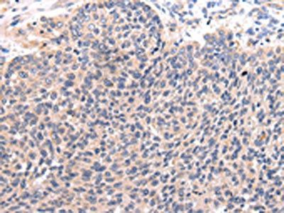 CCL7 Antibody