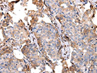 CCL7 Antibody