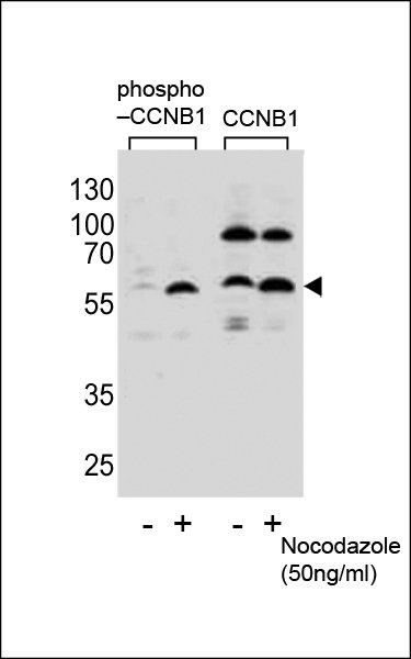 CCNB1 (phospho-S35) antibody