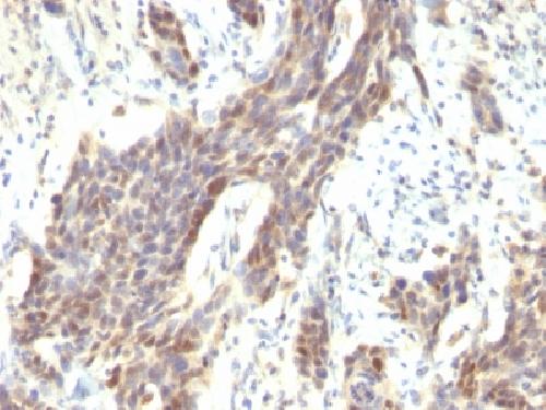 Cyclin D1 (G1-Cyclin & Mantle Cell Marker) Antibody