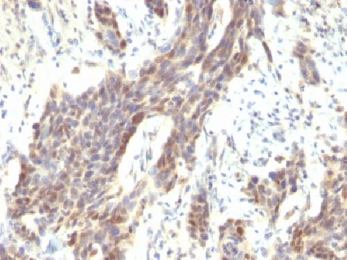 CCND1 antibody