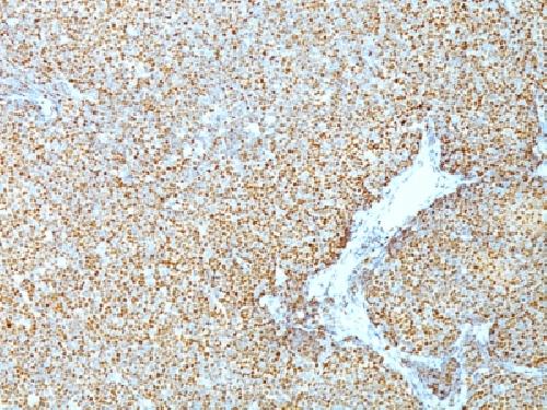 Cyclin D1 (G1-Cyclin & Mantle Cell Marker) Antibody