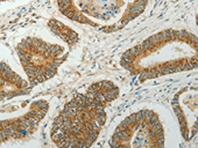 CCND1 Antibody
