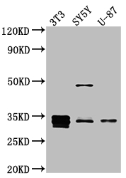 CCND1 Recombinant Monoclonal Antibody