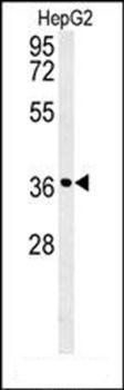 CCND1-Y226 antibody