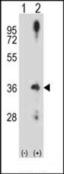CCND2 antibody