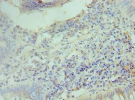 CCND2 Antibody