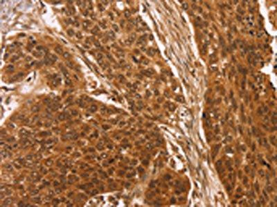 CCND2 Antibody