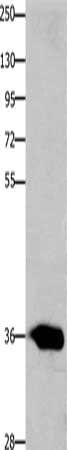 CCND2 Antibody