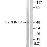 CCNE1 (Ab-395) Antibody