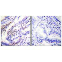 CCNE1 antibody