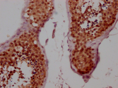 CCNE1 Recombinant Monoclonal Antibody