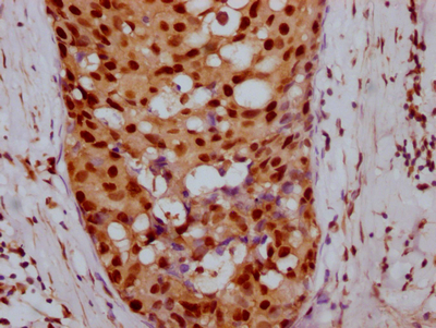 CCNE1 Recombinant Monoclonal Antibody