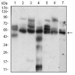 CCNE1 Antibody