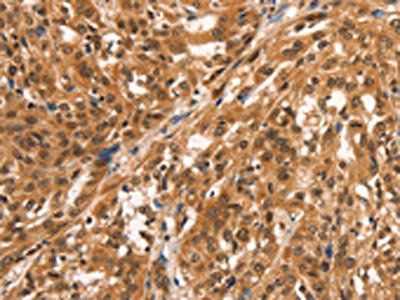 CCNE2 Antibody