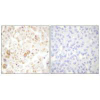CCNF Antibody