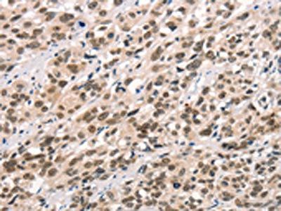 CCNT1 Antibody