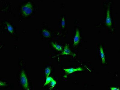 CCR1 antibody