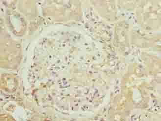 CCR1 Antibody