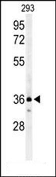 CCR1 antibody