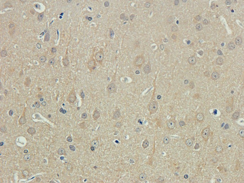 CCR1 antibody