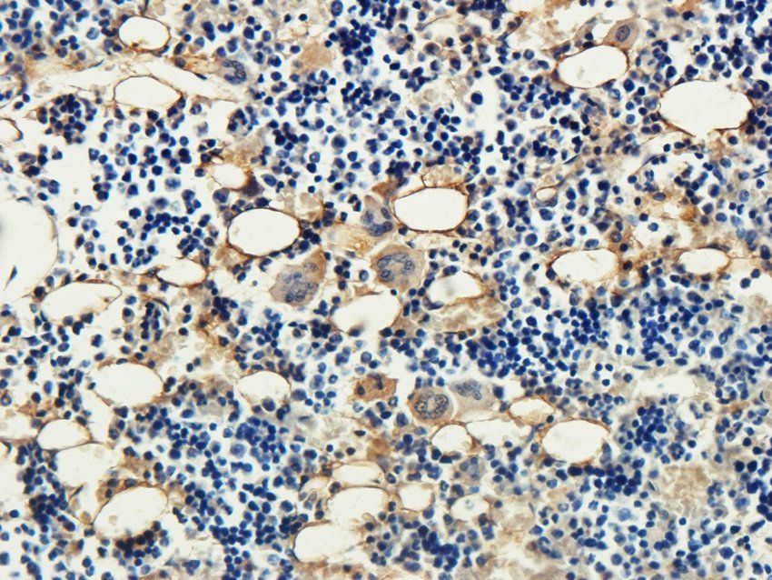 CCR1 antibody