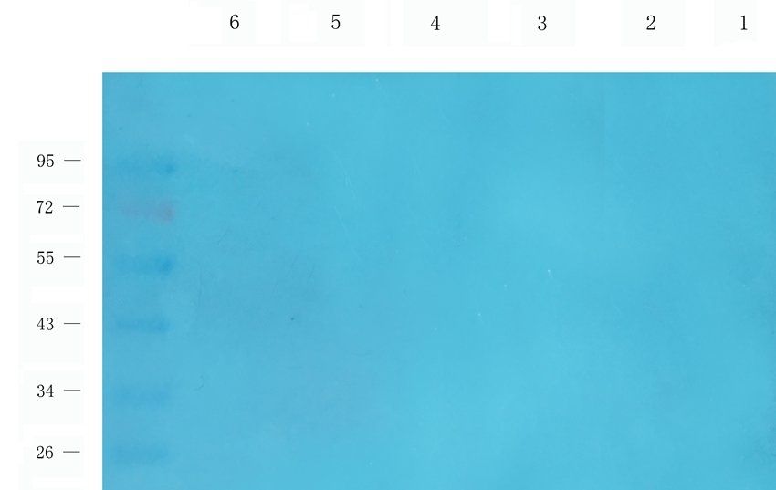 CCR1 antibody